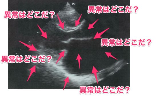 画像問題の正しい解き方