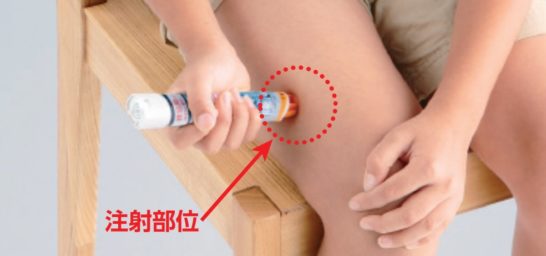 アドレナリンの筋注