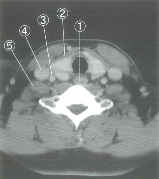 医師国家試験103G26_画像_頸部造影CT（総頸動脈）