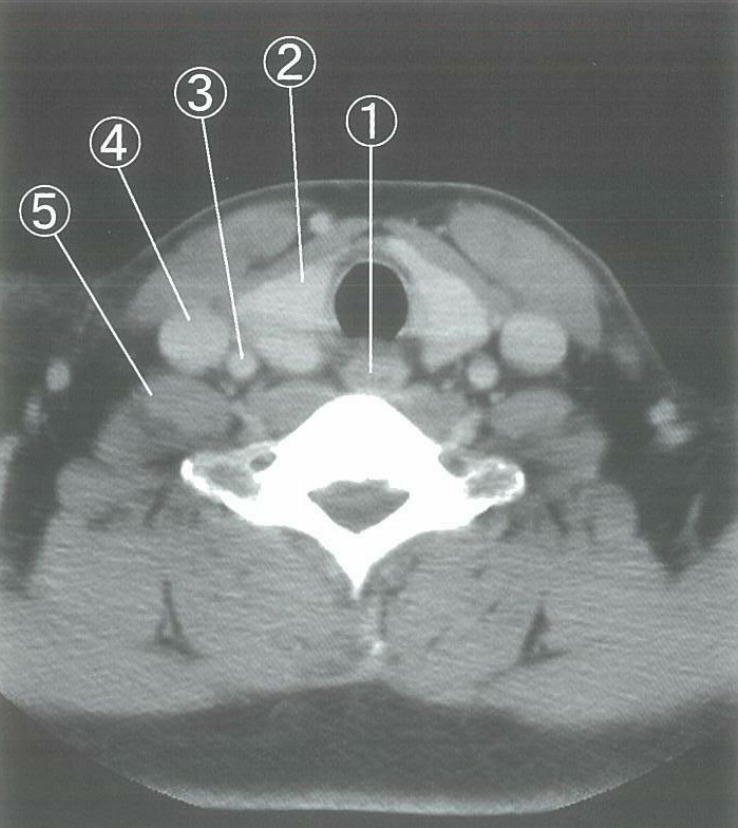 どれが総頸動脈？ 〜この画像が分かると臨床でどのように役に立つのか？〜 | コウメイ塾