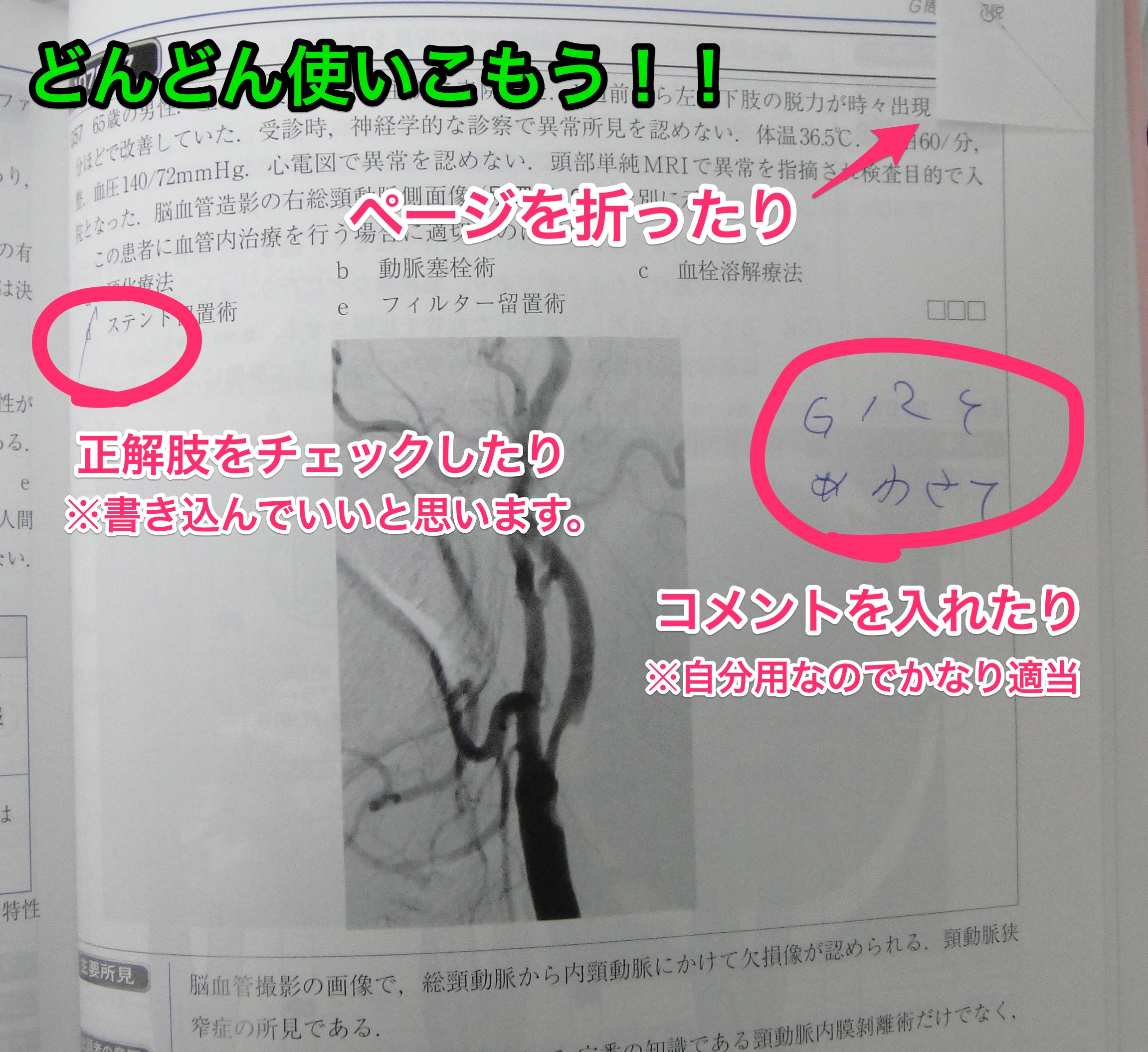 正しい問題集の使い方