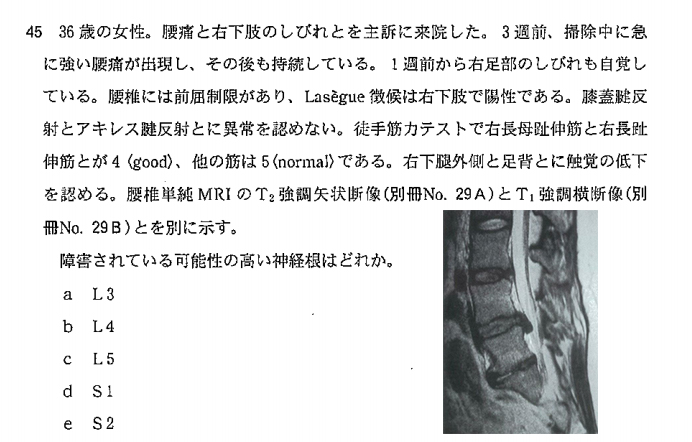 101g46(神経根の番号の付け方)