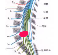 L5障害