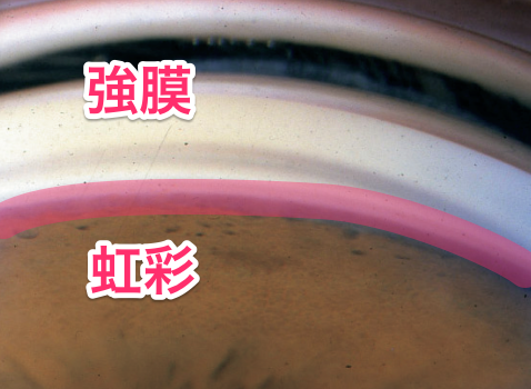 前房隅角