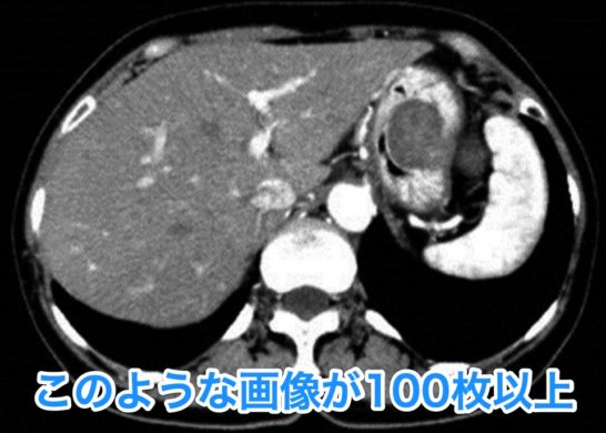 ダイナミックCT【108A43】