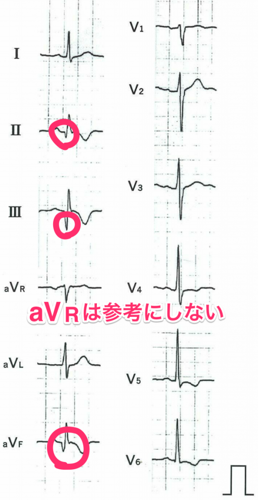 95D画像20-1 2