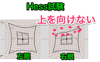 HESS試験