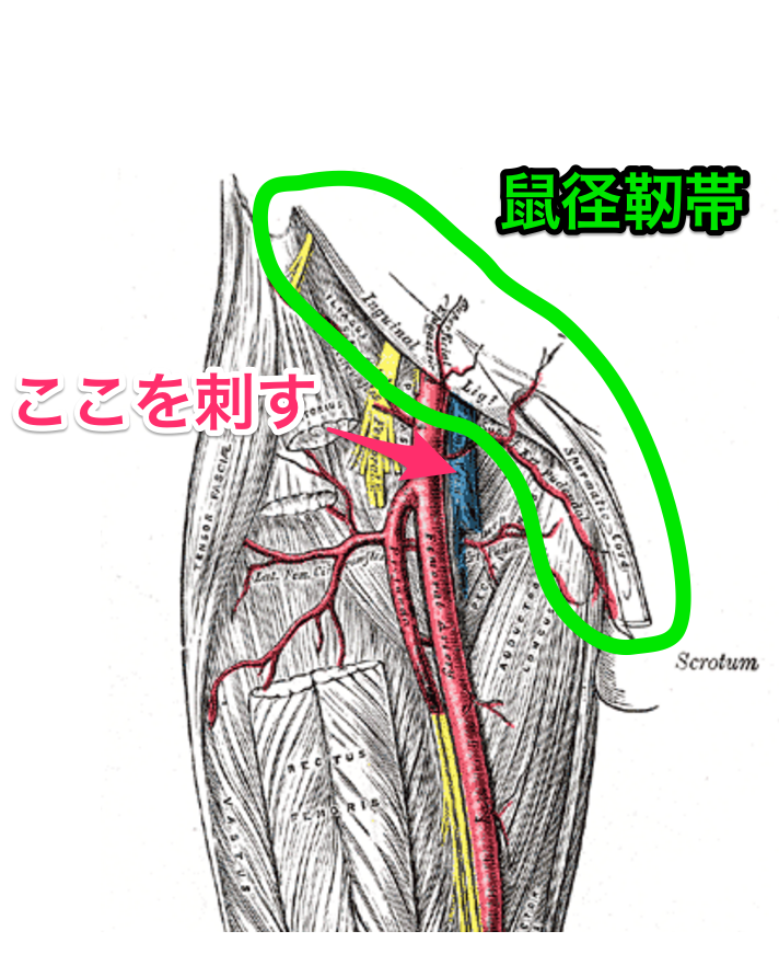 大腿静脈の穿刺部位