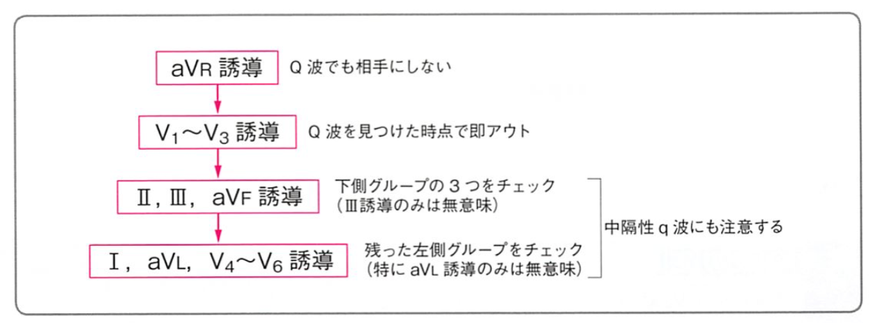 異常Q波の考え方